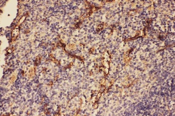 C5/C5a Rabbit Polyclonal Antibody