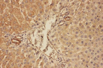C5/C5a Rabbit Polyclonal Antibody