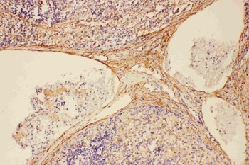C5/C5a Rabbit Polyclonal Antibody