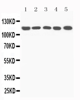 C5/C5a Rabbit Polyclonal Antibody