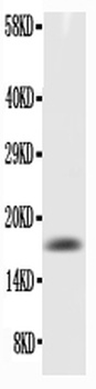 GM-CSF/CSF2/GM Rabbit Polyclonal Antibody