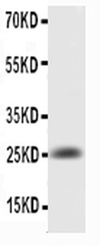 IL6 Rabbit Polyclonal Antibody