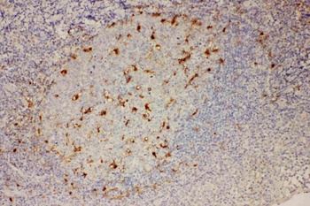 IL18 Rabbit Polyclonal Antibody