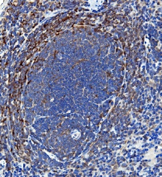IL18 Rabbit Polyclonal Antibody