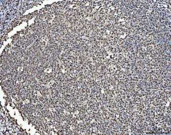 BRCA1 Rabbit Polyclonal Antibody