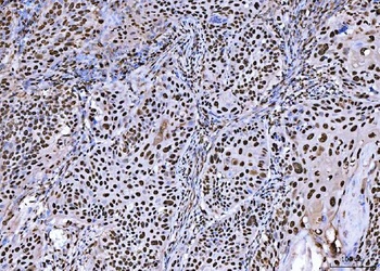 BRCA1 Rabbit Polyclonal Antibody