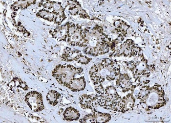 BRCA1 Rabbit Polyclonal Antibody