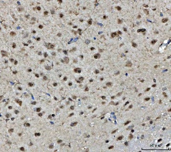 BRCA1 Rabbit Polyclonal Antibody