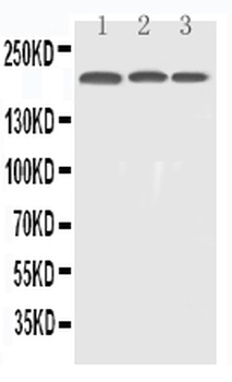 EGFR Rabbit Polyclonal Antibody