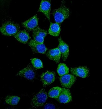 EGFR Rabbit Polyclonal Antibody