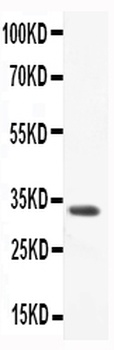 CCL3/Macrophage Inflammatory Protein 1 alpha Rabbit Polyclonal Antibody