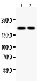 Topoisomerase II alpha/TOP2A Rabbit Polyclonal Antibody