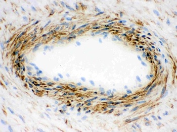 Actin ACTA1 Antibody (Monoclonal, AC-40)