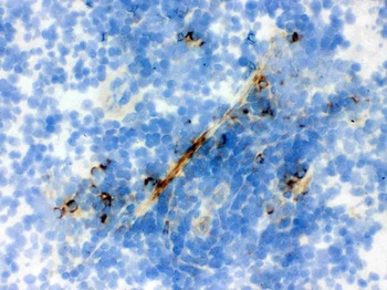 Actin ACTA1 Antibody (Monoclonal, AC-40)