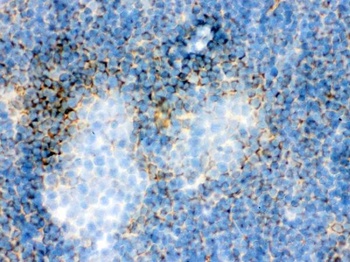 Actin ACTA1 Antibody (Monoclonal, AC-40)