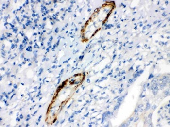 Caldesmon Antibody