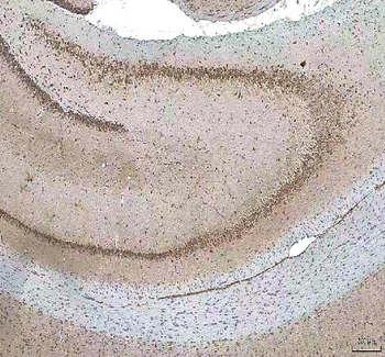 HCRT Rabbit Polyclonal Antibody