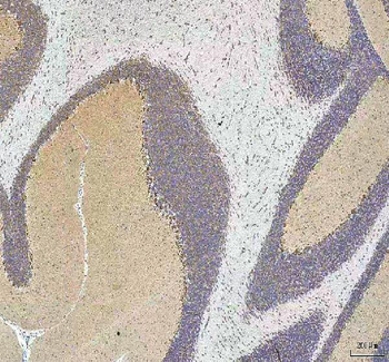 HCRT Rabbit Polyclonal Antibody