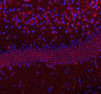 HCRT Rabbit Polyclonal Antibody