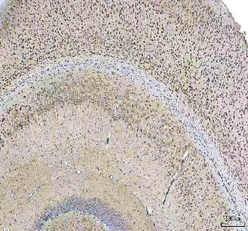 HCRT Rabbit Polyclonal Antibody