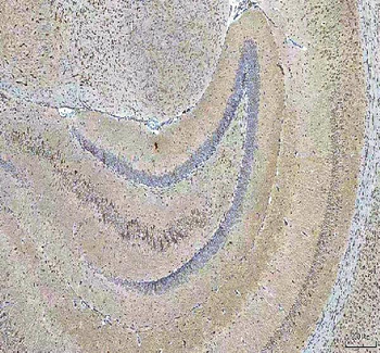 HCRT Rabbit Polyclonal Antibody