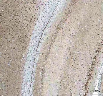 HCRT Rabbit Polyclonal Antibody