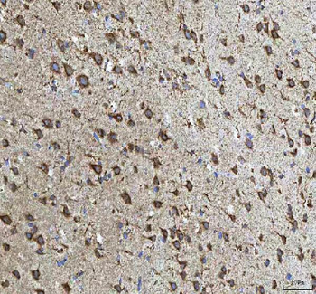 HCRT Rabbit Polyclonal Antibody