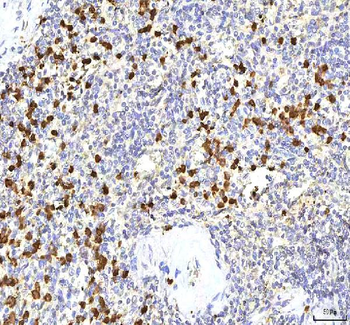 S100A12 Rabbit Polyclonal Antibody