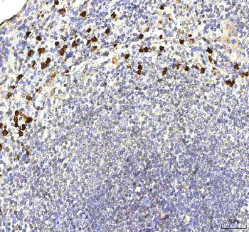 S100A12 Rabbit Polyclonal Antibody