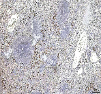 S100A12 Rabbit Polyclonal Antibody