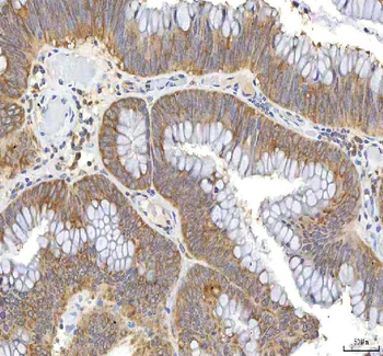 OCM Rabbit Polyclonal Antibody