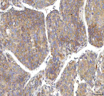 OCM Rabbit Polyclonal Antibody