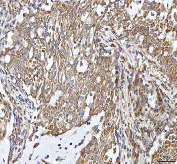 OCM Rabbit Polyclonal Antibody