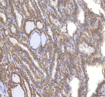 OCM Rabbit Polyclonal Antibody