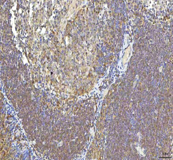 OCM Rabbit Polyclonal Antibody