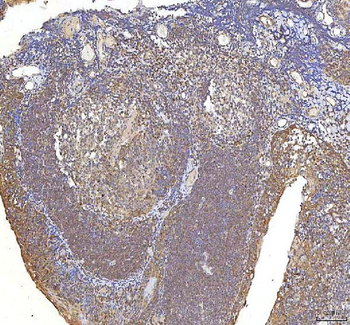 OCM Rabbit Polyclonal Antibody