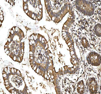 SMIM8 Rabbit Polyclonal Antibody