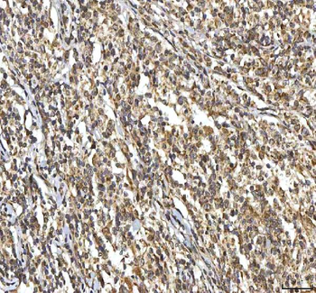 SMIM8 Rabbit Polyclonal Antibody