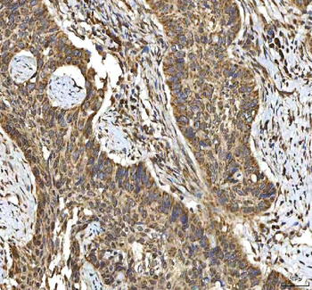 SMIM8 Rabbit Polyclonal Antibody