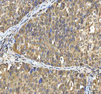 SMIM8 Rabbit Polyclonal Antibody