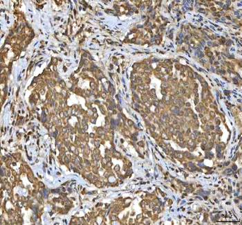 SMIM8 Rabbit Polyclonal Antibody
