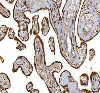 SMIM8 Rabbit Polyclonal Antibody