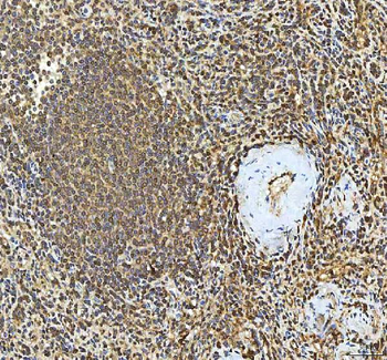 SMIM8 Rabbit Polyclonal Antibody