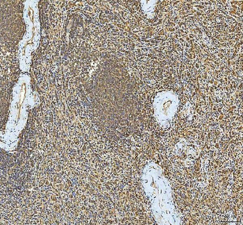 SMIM8 Rabbit Polyclonal Antibody