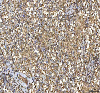 SMIM8 Rabbit Polyclonal Antibody