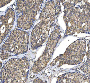 Huntingtin/HTT Rabbit Polyclonal Antibody