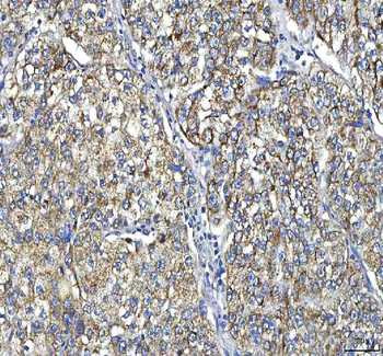 Huntingtin/HTT Rabbit Polyclonal Antibody