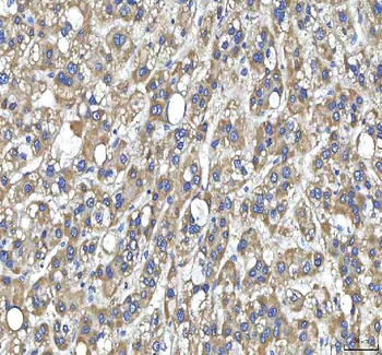 Huntingtin/HTT Rabbit Polyclonal Antibody