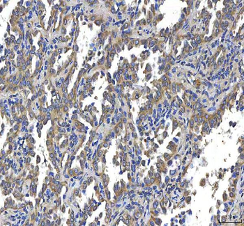 Huntingtin/HTT Rabbit Polyclonal Antibody