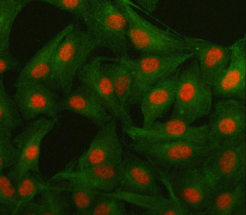 Islet 1/ISL1 Rabbit Polyclonal Antibody